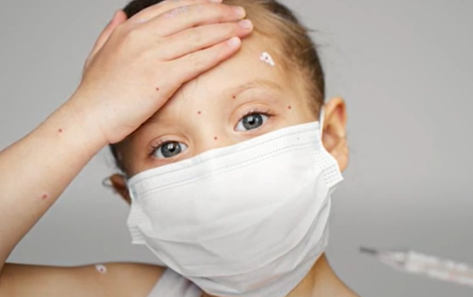 Sudah 5.000 Kasus, Waspadai Flu Singapura saat Mudik