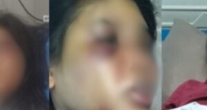 Asa Perbaiki Nasib jadi ART Intan Kandas, Jadi Korban KDRT oleh Majikan